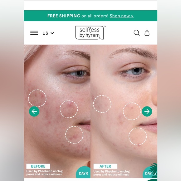 Selfless by Hyram Salicylic Acid & Sea Kelp Pore Clearing and Oil Control Serum - Picture 3 of 3